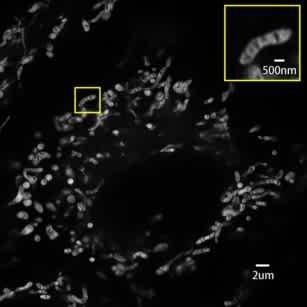 Real time live cell imaging of mitochondria (10FPS).