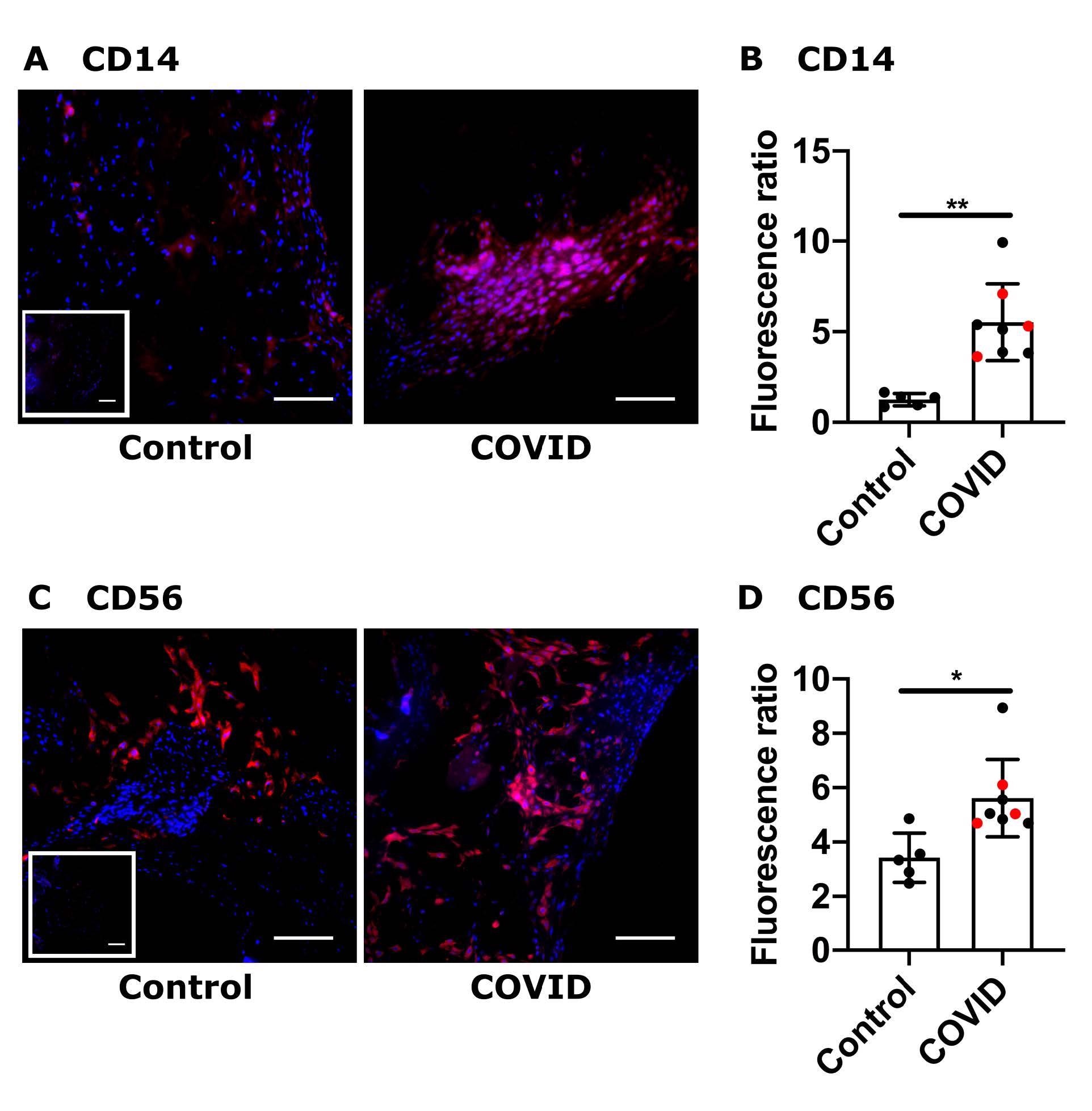 Placental maternal immune cell infiltrates from retrospective COVID-19 cohort. (A, C) Representative images (200x) of decidual areas stained for (A) CD14 (red) or (C) CD56 (red) immunofluorescence. (B, D) Graphical analysis of comparative fluorescence quantitation of (B) CD14 and (D) CD56. Red circles indicate dyads with an infant who tested positive for SARS-CoV-2 by nasal PCR swab at 24 or 48 hours of life. SARS-CoV-2 positive (COVID, n = 8) or negative (control, n = 5). * p <0.05; ** p <0.01. Scale bar: 50μm; insets: secondary-only controls.