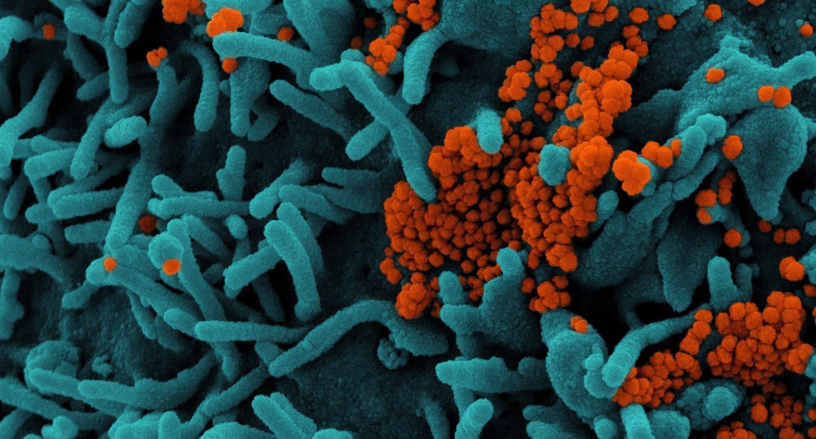 Study: Transmission of B.1.617.2 Delta Variant between vaccinated healthcare workers. Image Credit: NIAID