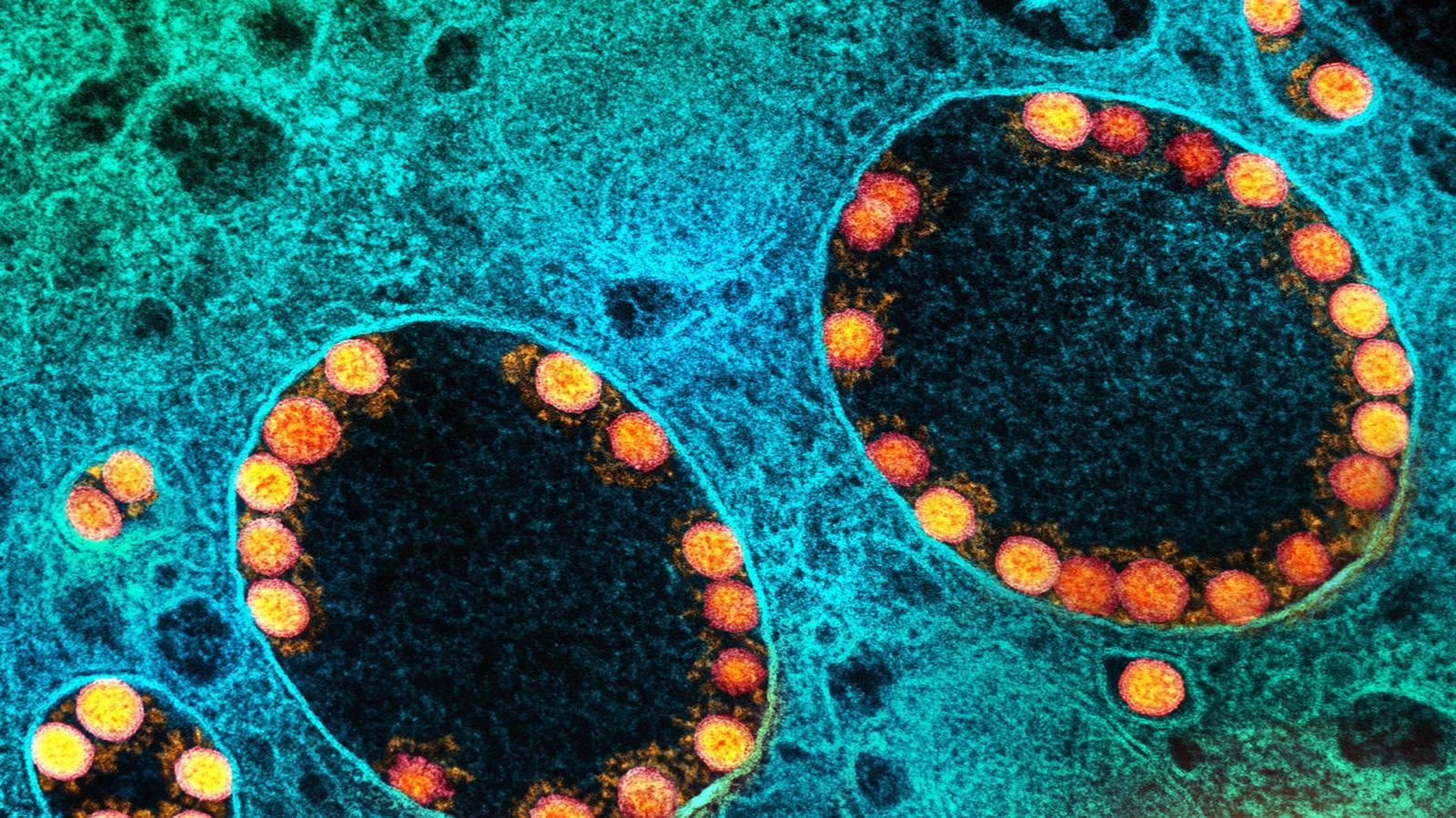 Study: Distinct SARS-CoV-2 sensing pathways in pDCs driving TLR7-antiviral vs. TLR2-immunopathological responses in COVID-19. Image Credit: NIAID