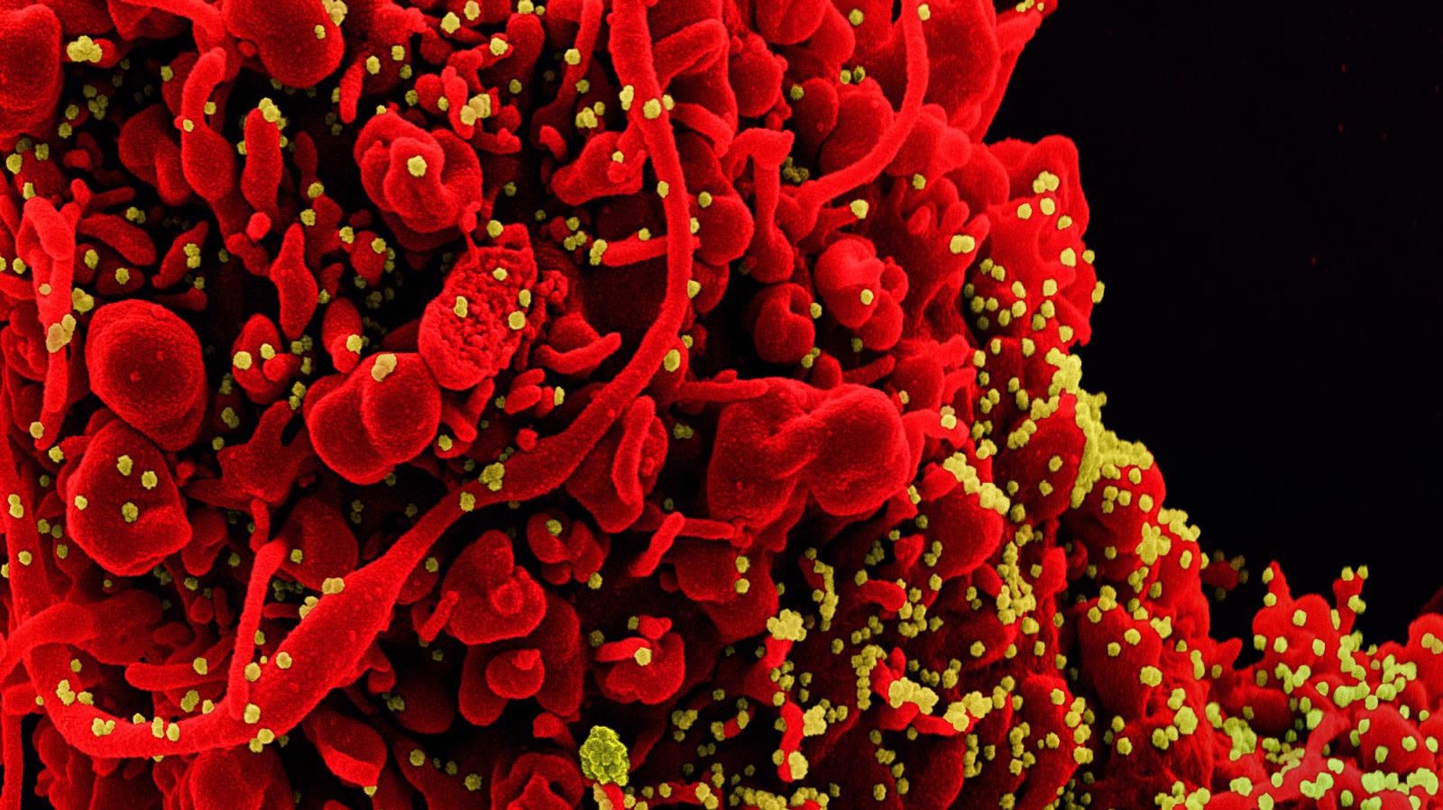 Study: SARS-CoV-2 ORF10 suppresses the antiviral innate immune response by degrading MAVS through mitophagy. Image Credit: NIAID