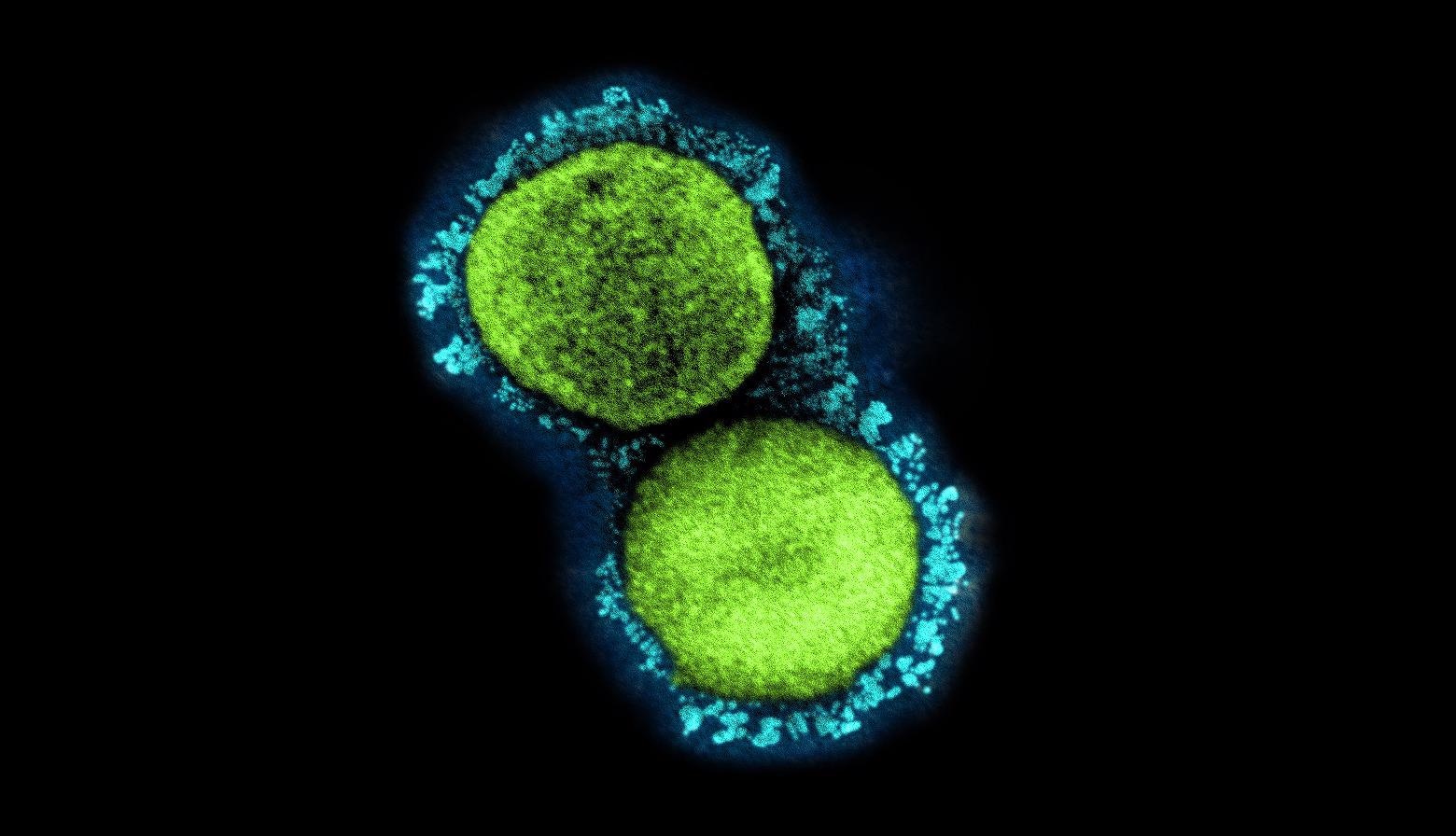 Study: A simple model of COVID-19 explains disease severity and the effect of treatments. Image Credit: NIAID