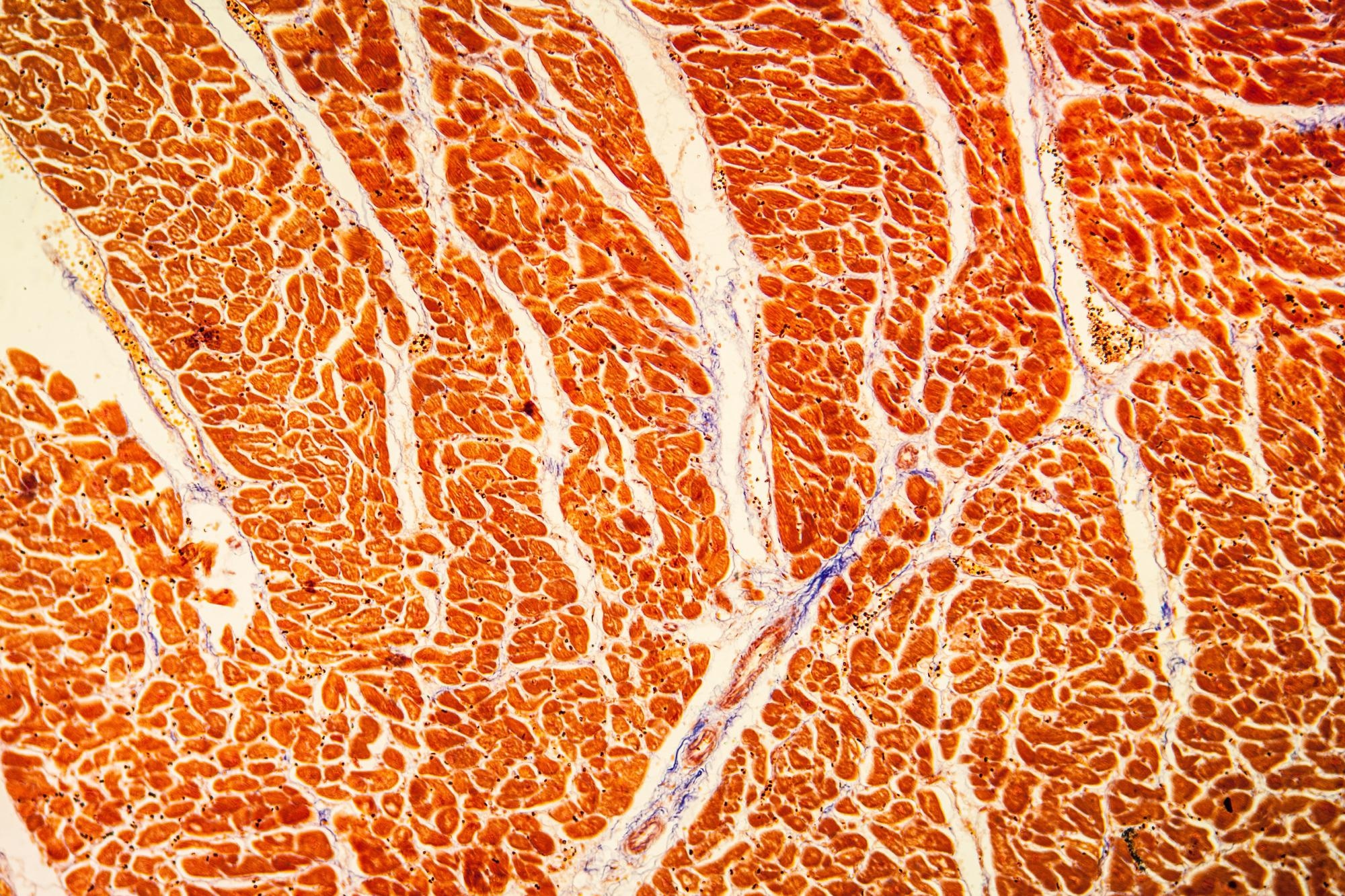 Study: Clinically Suspected Myocarditis Temporally Related to COVID-19 Vaccination in Adolescents and Young Adults. Image Credit: Dr. Norbert Lange