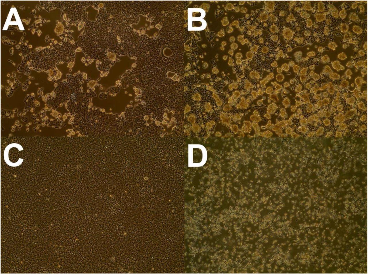 Observed cytopathic effect in VeroE6 cells inoculated with nasal swabs from SARS-CoV-2 positive white-tailed deer at 5 days post-infection (A-4055, B-4249) with a mock-inoculated negative control (C) and positive control inoculated with a nasopharyngeal clinical specimen from a COVID-19 patient (D). Magnification was 100x.