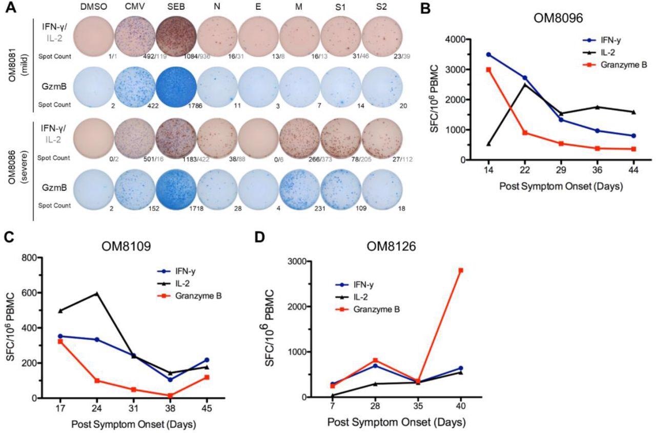 Stronger overall T cell cytokine ELISpot responses detected in severe patients and overall ELISpot responses of acute patients in the first six weeks PSO. (A) Representative cytokine ELISpot responses from individuals with mild or severe severe illness against SARS-CoV-2 structural proteins (N, E, M, S1 & S2), with DMSO as negative control and CMV and SEB as positive controls. Numbers indicate the number of spot forming cells for IFN-γ/IL-2 or GzmB. (B)-(D) Three subjects with acute moderate COVID-19 infection were followed weekly shortly after symptom onset for up to 6 weeks PSO. Total additive response to the four SARS-CoV-2 structural proteins was measured by ELISpot for each cytokine.
