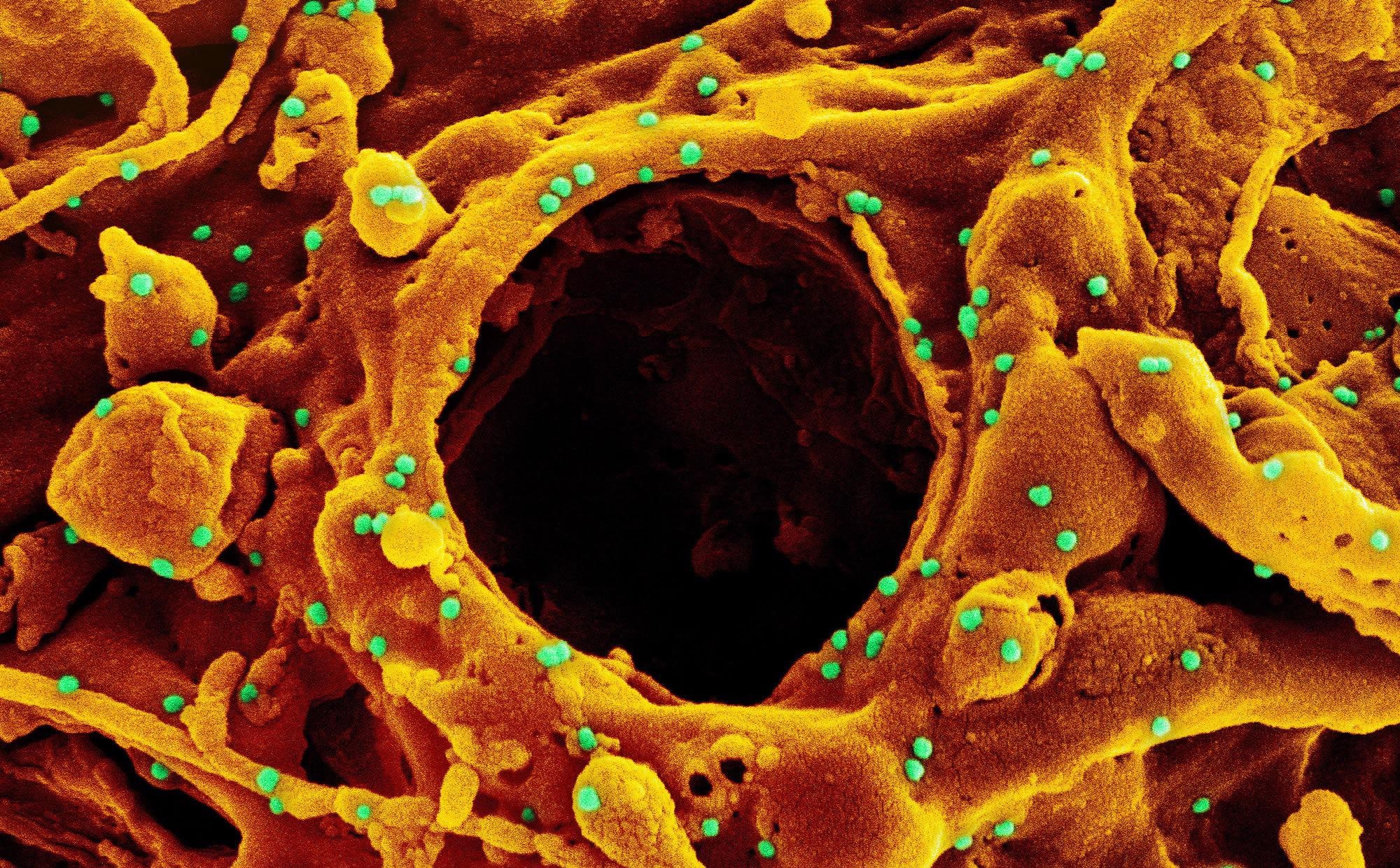 Study: Serum Neutralizing Activity of mRNA-1273 Against the SARS-CoV-2 B.1.1.529 (Omicron) Variant: A Preliminary Report. Image Credit: NIAID
