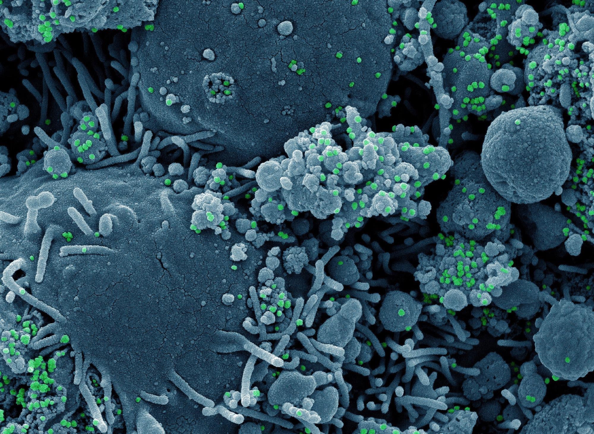 Study: Crystal structures and fragment screening of SARS-CoV-2 NSP14 reveal details of exoribonuclease activation and mRNA capping and provide starting points for antiviral drug development. Image Credit: NIAID
