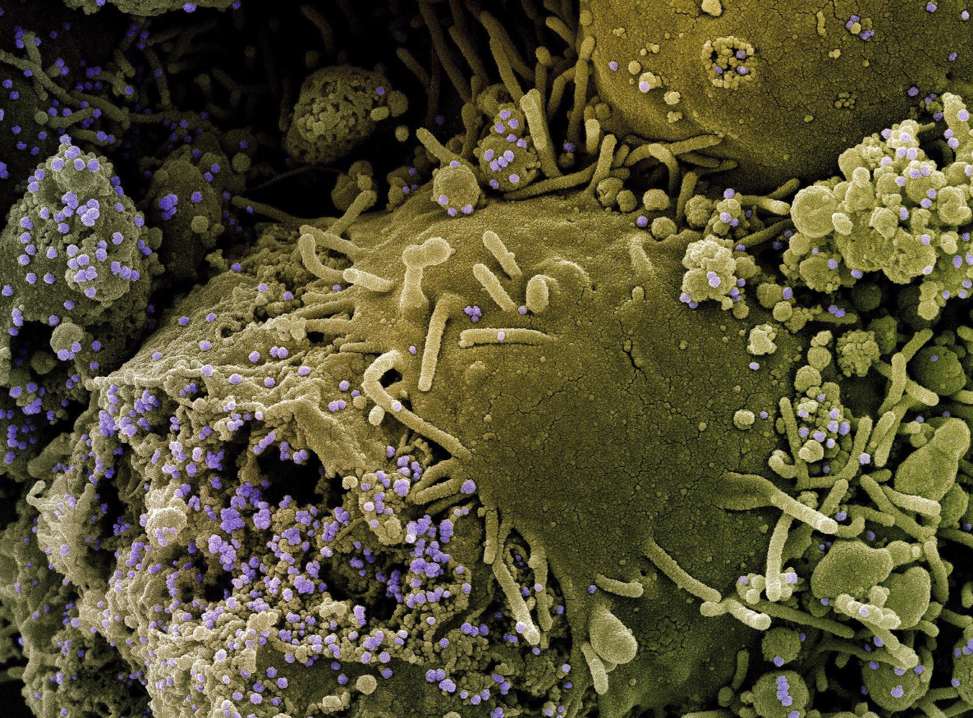 Study: Rapid and parallel adaptive mutations in spike S1 drive clade success in SARS-CoV-2. ​​​​​​​Image Credit: NIAID