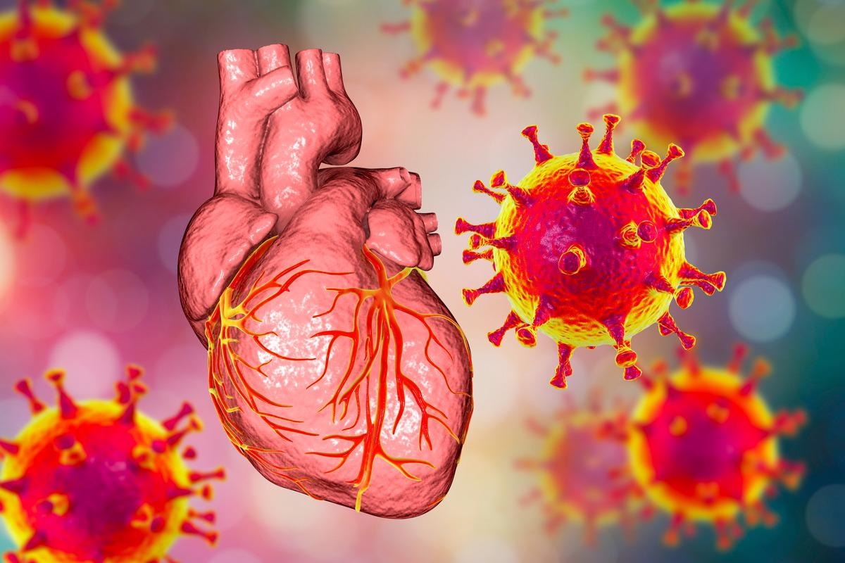 Study: Cardiac impairment in Long Covid 1-year post-SARS-CoV-2 infection. Image Credit: Kateryna Kon/Shutterstock