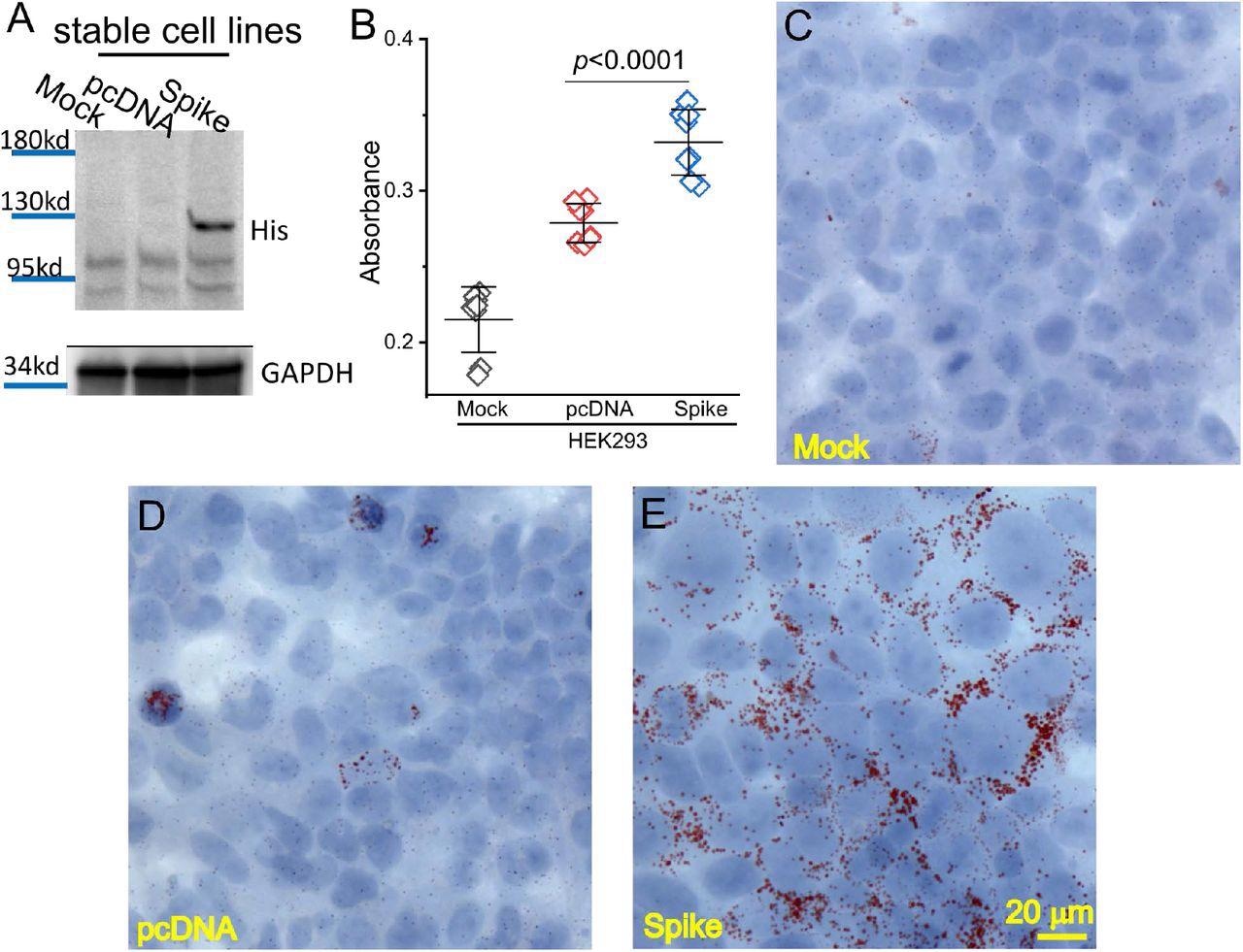 Spike protein caused lipid deposition in host cells. (A) Generation of Spike protein stable cell line. The expression of Spike protein was verified using an anti-His tag antibody in the Spike cells. (B) The quantification of Oil Red O staining in the mock, pcDNA, and Spike cells with measurement of an absorbance at 492 nm. (C-E) Histological images showing Oil Red O staining of lipid droplets in the mock (C), pcDNA (D), and Spike (E) cells. Nuclear components were counterstained by hematoxylin
