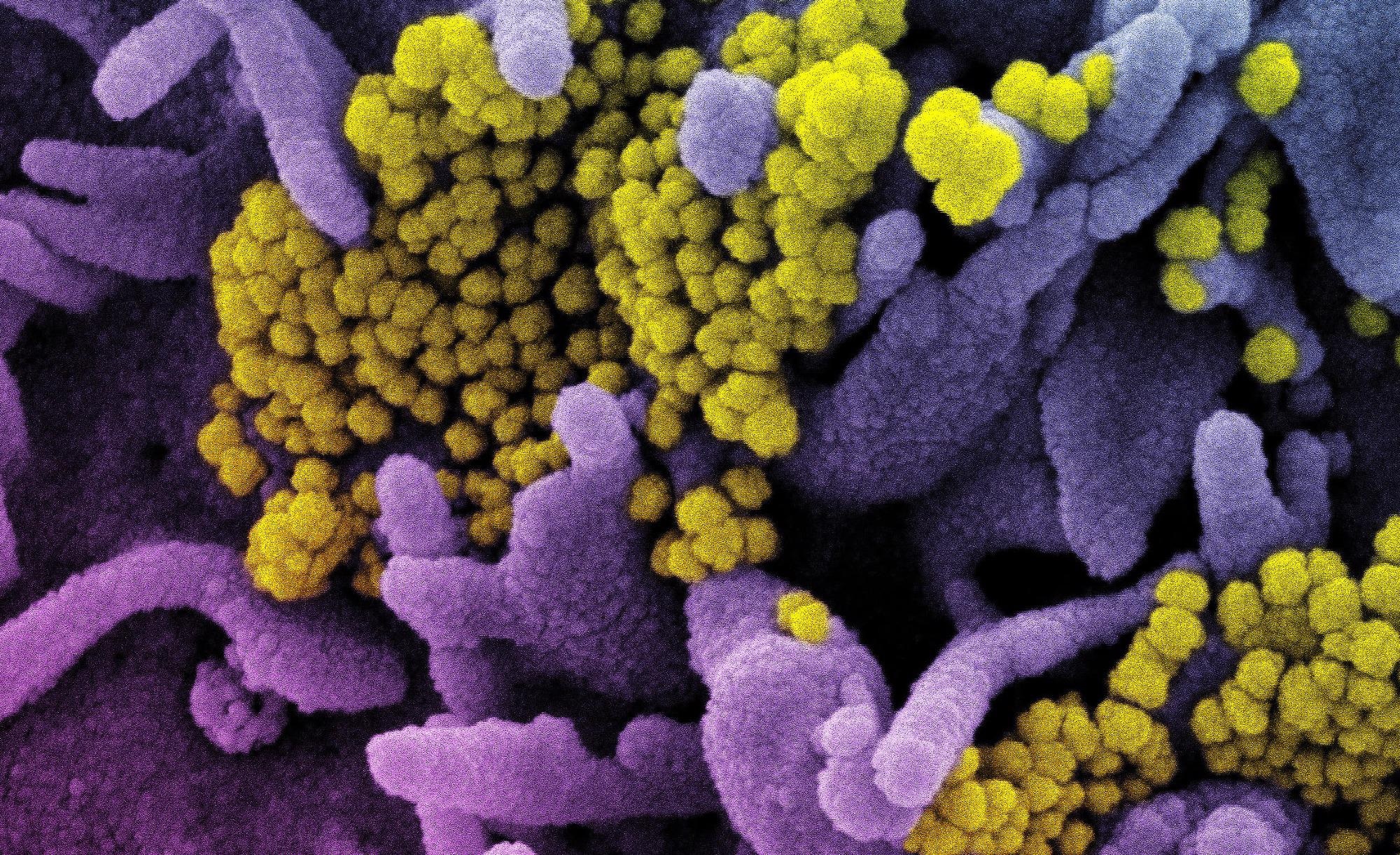 Study: SARS-CoV-2 evolution and patient immunological history shape the breadth and potency of antibody-mediated immunity. Image Credit: NIAID