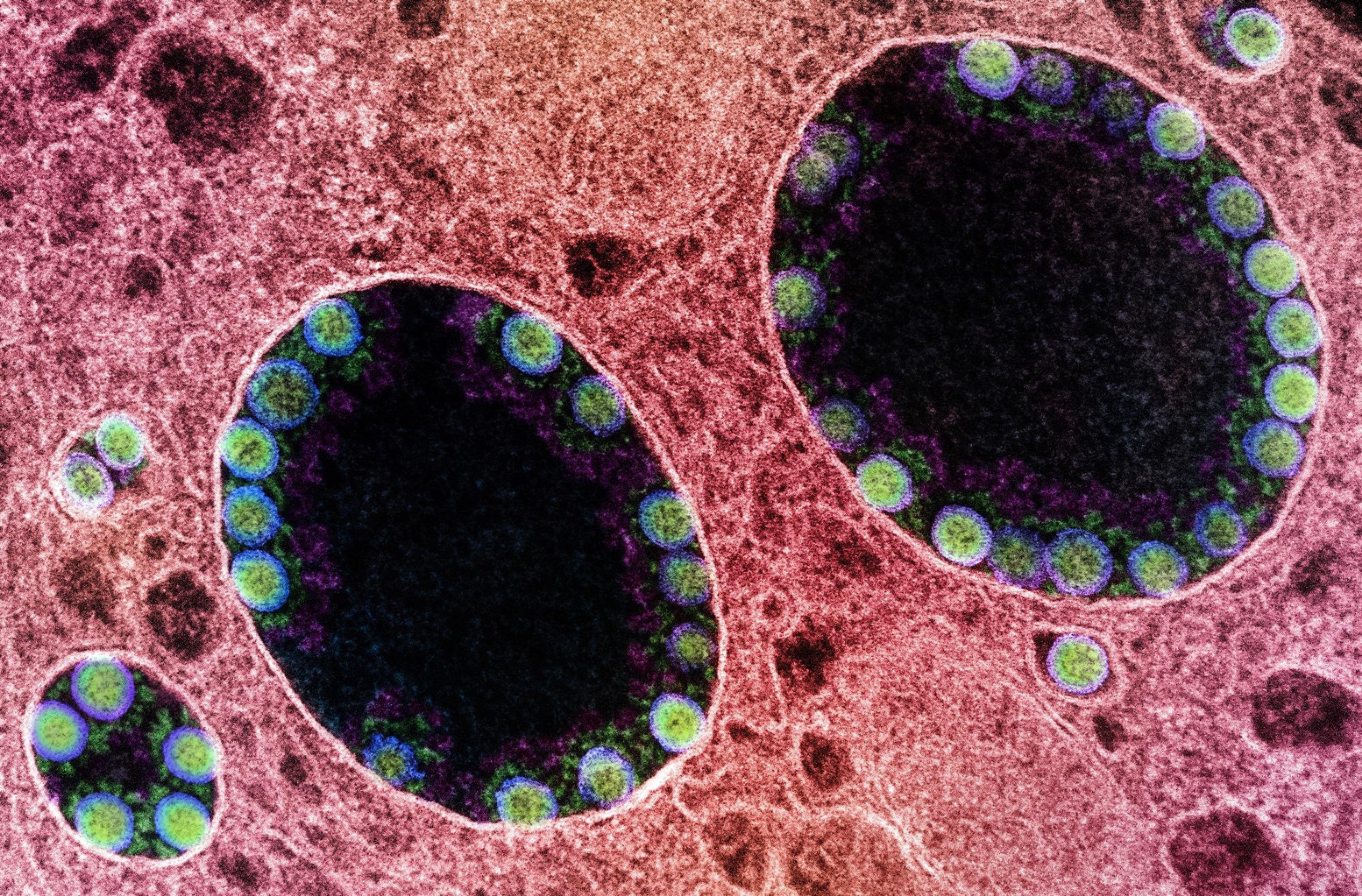 Study: Variation in the ACE2 receptor has limited utility for SARS-CoV-2 host prediction. Image Credit: NIAID
