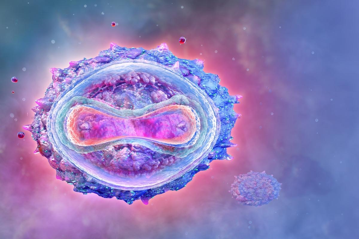 Study: Clinical features and management of human monkeypox: a retrospective observational study in the UK. Image Credit: Corona Borealis Studio/Shutterstock