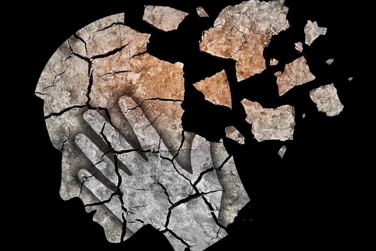 Study: Post-acute COVID-19 cognitive impairment and decline uniquely associate with kynurenine pathway activation: a longitudinal observational study. Image Credit: jiris/Shutterstock