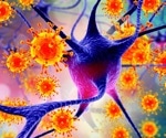 Study confirms link between Epstein-Barr virus and multiple sclerosis
