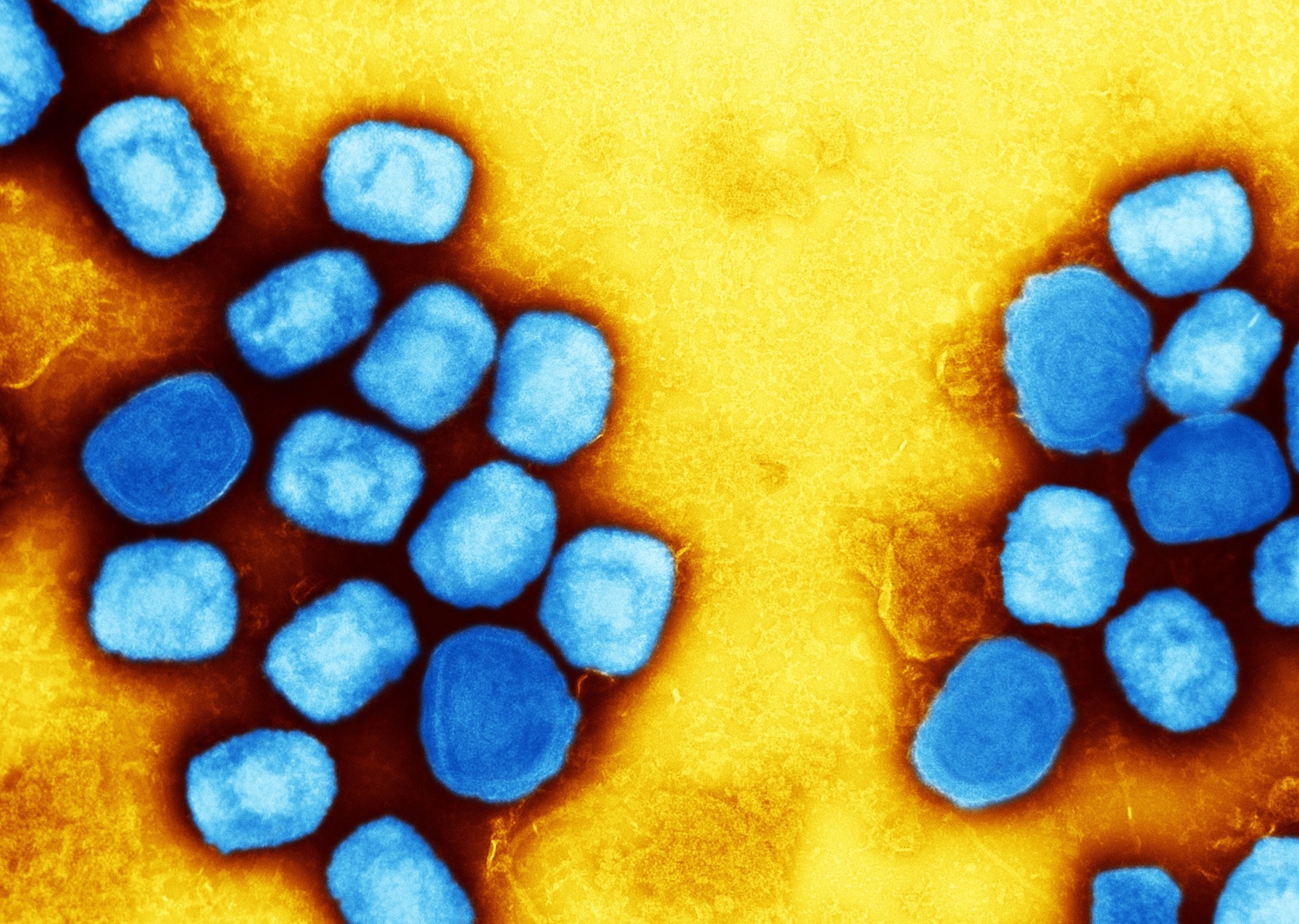 Study: Antivirals with Activity Against Monkeypox: A Clinically Oriented Review. Image Credit: NIAID