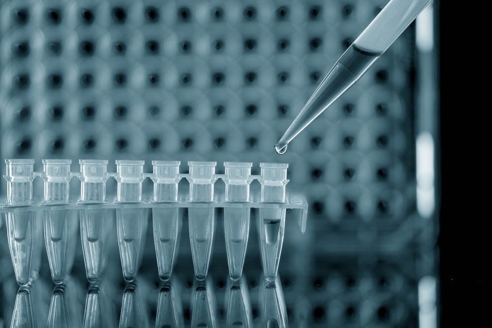 Study: Monkeypox: Another Test for PCR. Image Credit: luchschenF / Shutterstock.com