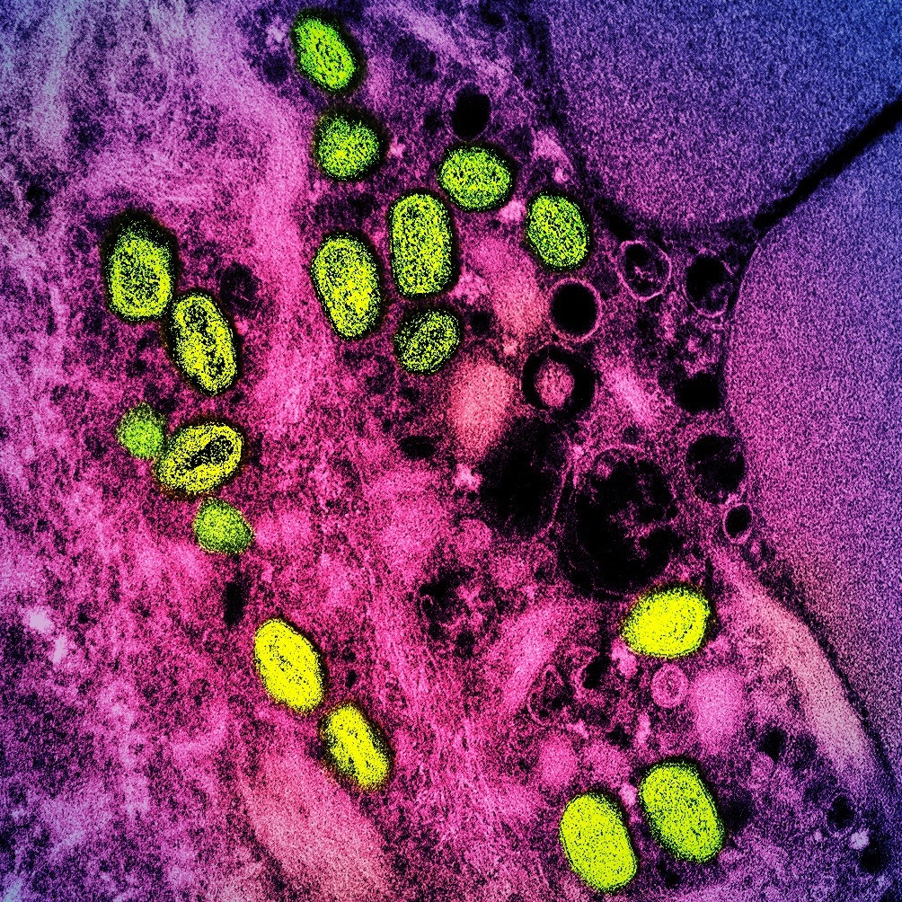 Study: Modeling the Impact of Sexual Networks in the Transmission of Monkeypox virus Among Gay, Bisexual, and Other Men Who Have Sex With Men — United States, 2022. Image Credit: NIAID
