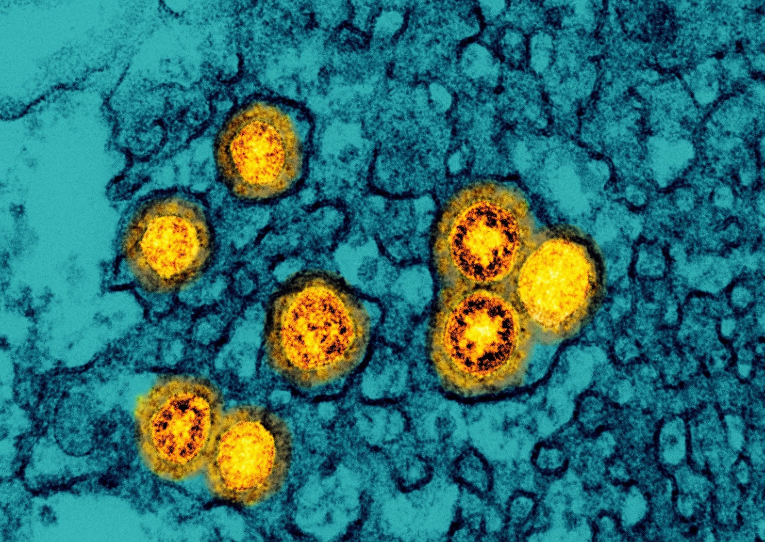 Study: The FDA-approved drug Auranofin has a dual inhibitory effect on SARS-CoV-2 entry and NF-κB signaling. Image Credit: NIAID