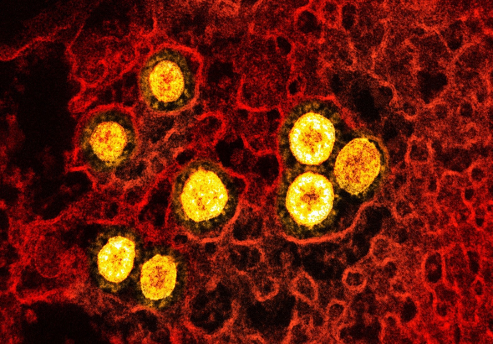 Study: A novel biopolymer for mucosal adjuvant against respiratory pathogens. Image Credit: NIAID