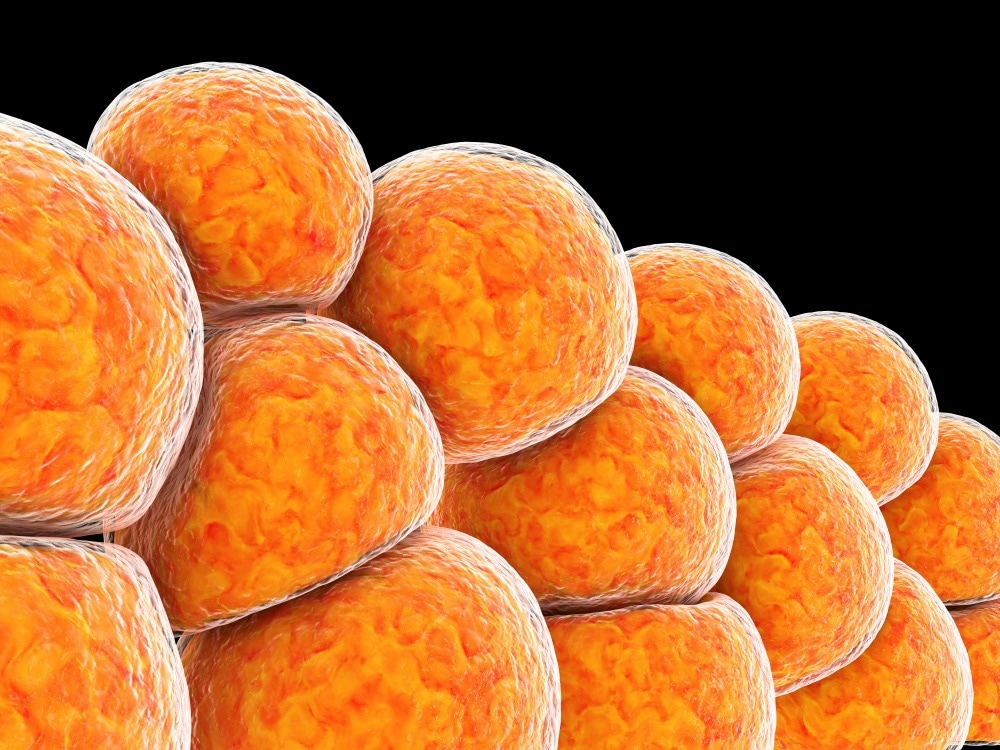 Study: SARS-CoV-2 infects adipose tissue in a fat depot- and viral lineage-dependent manner. Image Credit: Victor Josan/Shutterstock