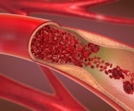 Researchers fabricate a non-porous biodegradable vascular graft