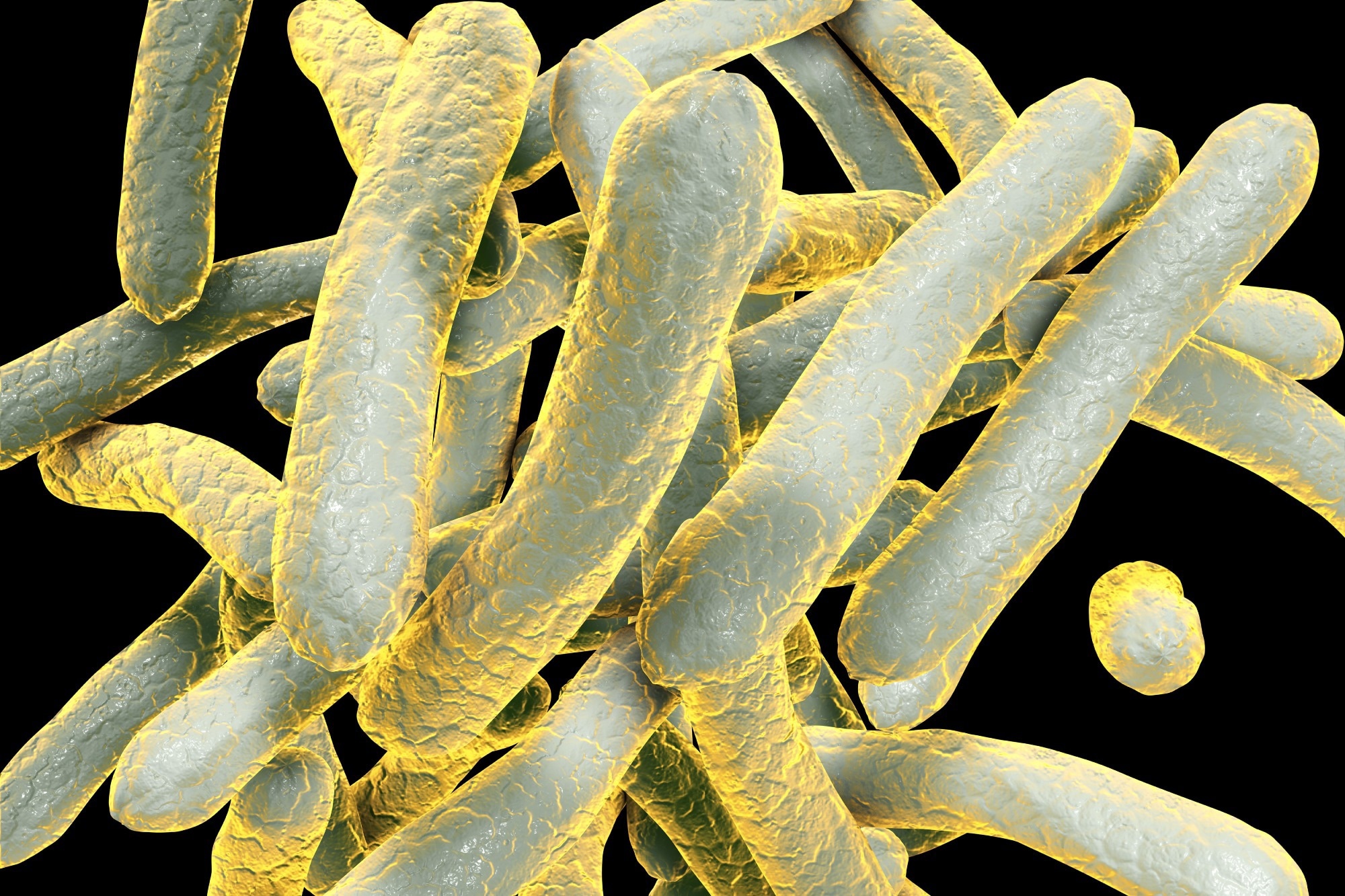 Global tuberculosis report 2022. Image Credit: Kateryna Kon / Shutterstock