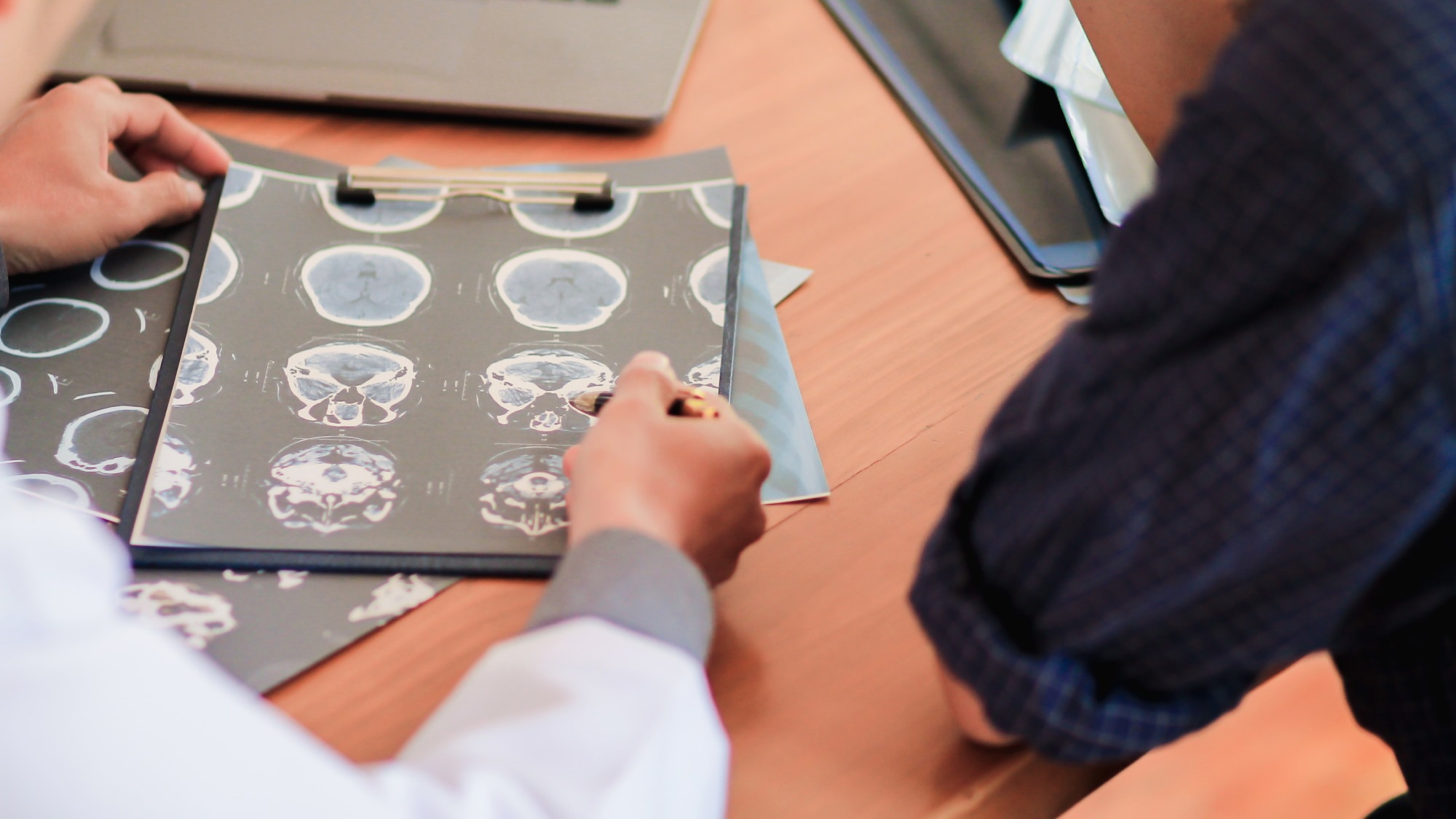 Study: SARS-CoV-2 infects neurons and induces neuroinflammation in a non-human primate model of COVID-19. Image Credit: Korawat photo shoot/Shutterstock