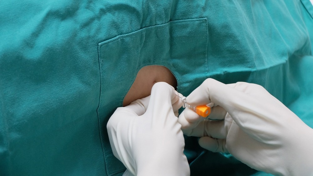 Study: Neurologic sequalae of COVID-19 are determined by immunologic imprinting from previous Coronaviruses. Image Credit: Casa nayafana/Shutterstock