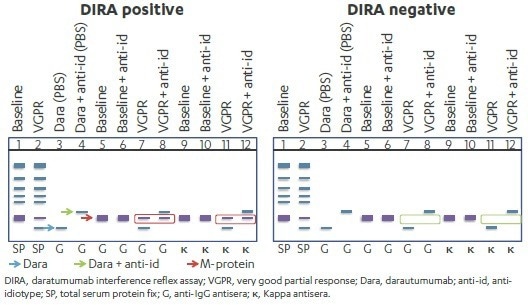 How to assess clinical response in multiple myeloma