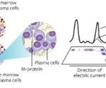 How to assess clinical response in multiple myeloma