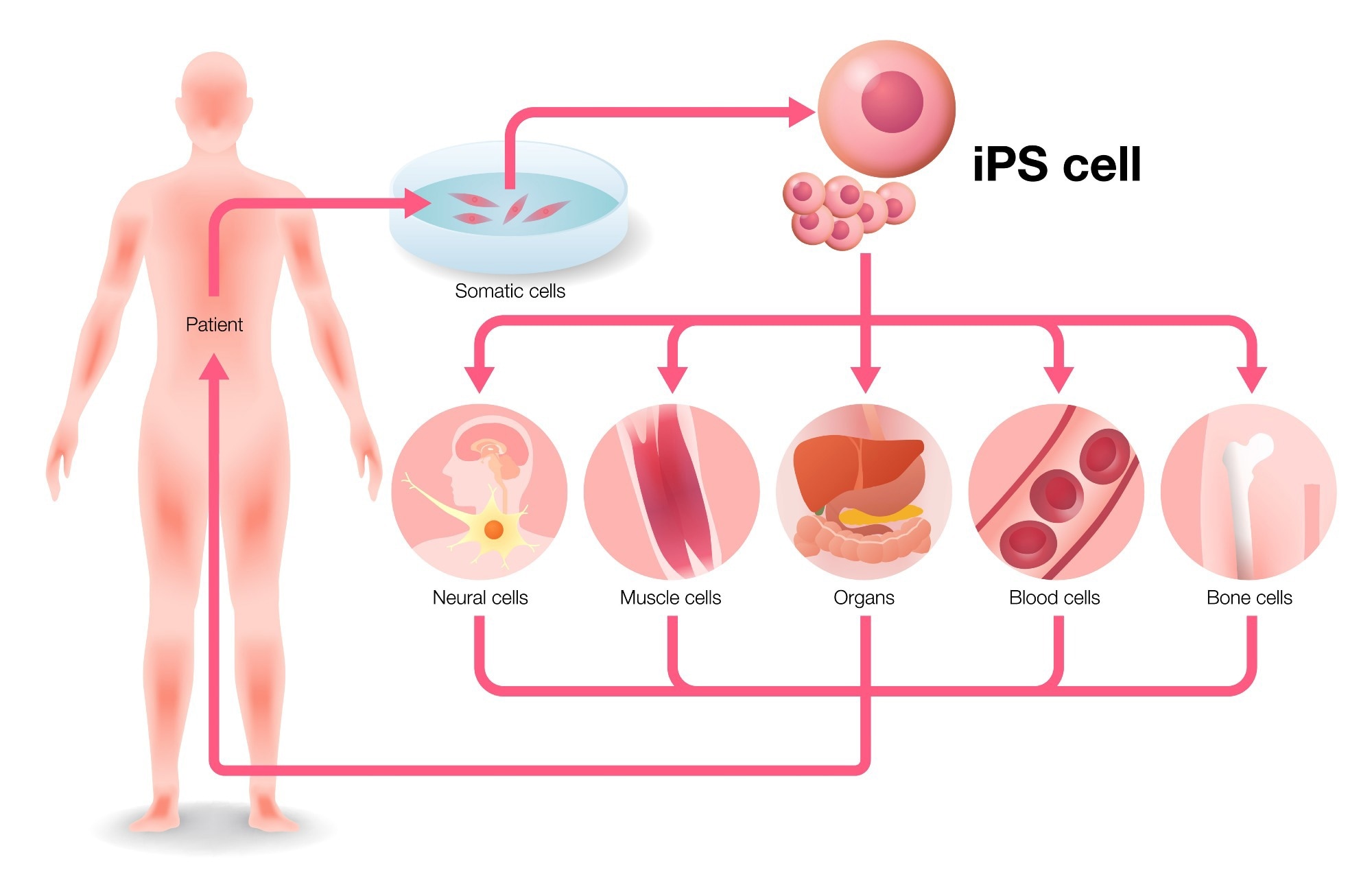 induced pluripotent stem cells