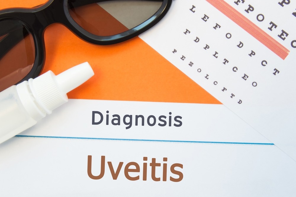 Study: The Microbiome and Uveitis: A Narrative Review. Image Credit: Shidlovski/Shutterstock.com