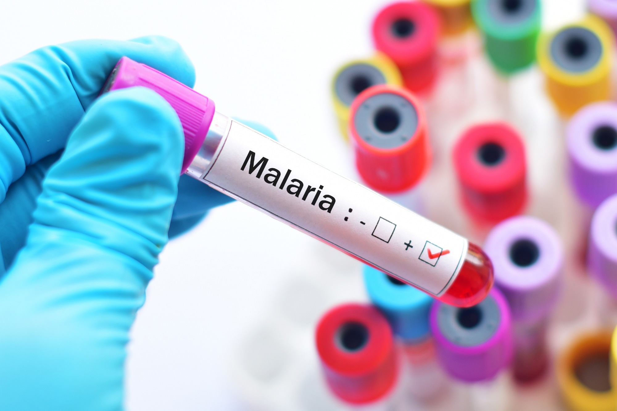 Study: Symptomatic malaria enhances protection from reinfection with homologous Plasmodium falciparum parasites. Image Credit: JarunOntakrai/Shutterstock.com