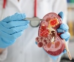 Kidney transplantation turns back the clock on renal aging