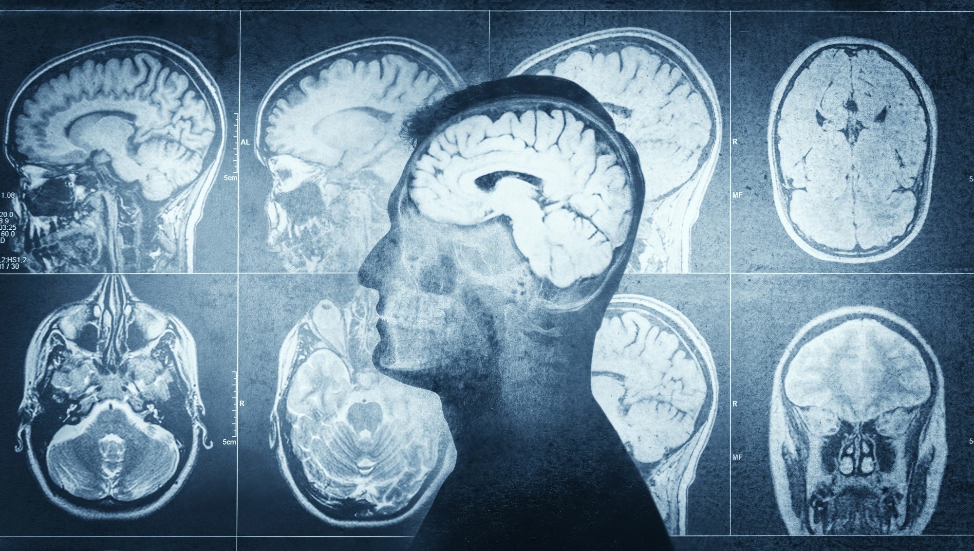 Study: The spatiotemporal dynamics of semantic integration in the human brain. Image Credit: Triff / Shutterstock.com