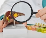 Study links lifestyle choices and gender to severity of fatty liver disease in workers