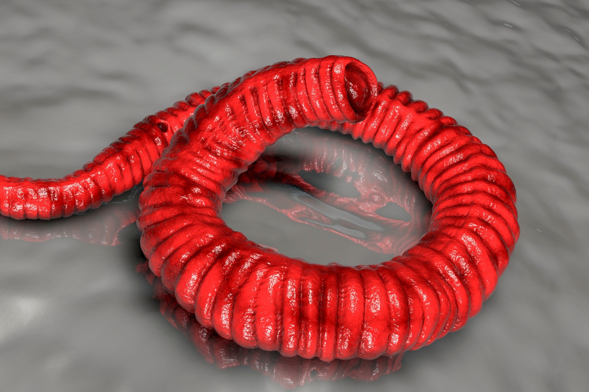 Progress Toward Eradication of Dracunculiasis — Worldwide, January 2022–June 2023. Image Credit: Kateryna Kon / Shutterstock