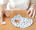 Is posttraumatic epilepsy associated with long-term dementia risk?