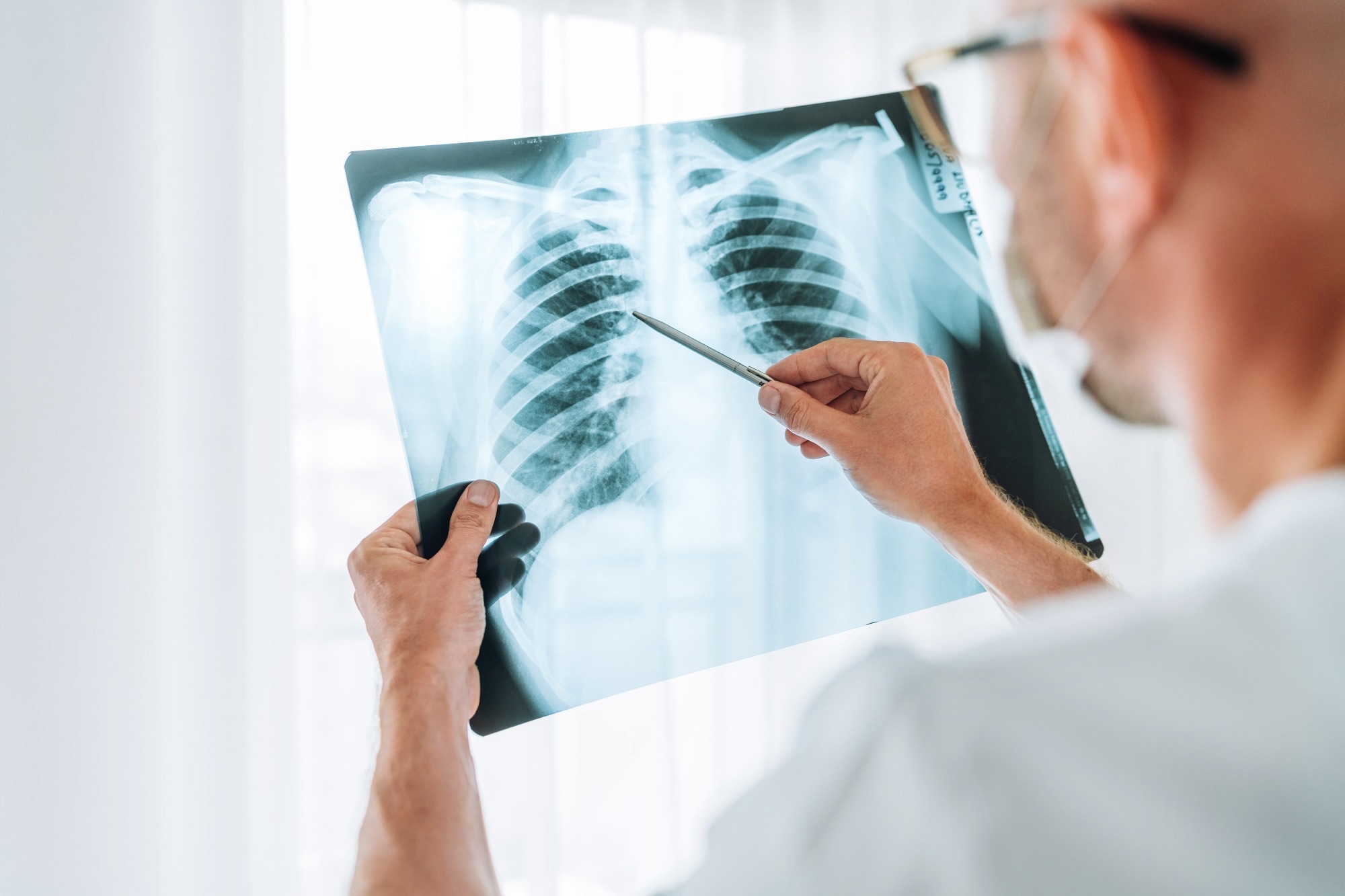 Study: Potential of GPT-4 for Detecting Errors in Radiology Reports: Implications for Reporting Accuracy. Image Credit: Soloviova Liudmyla / Shutterstock