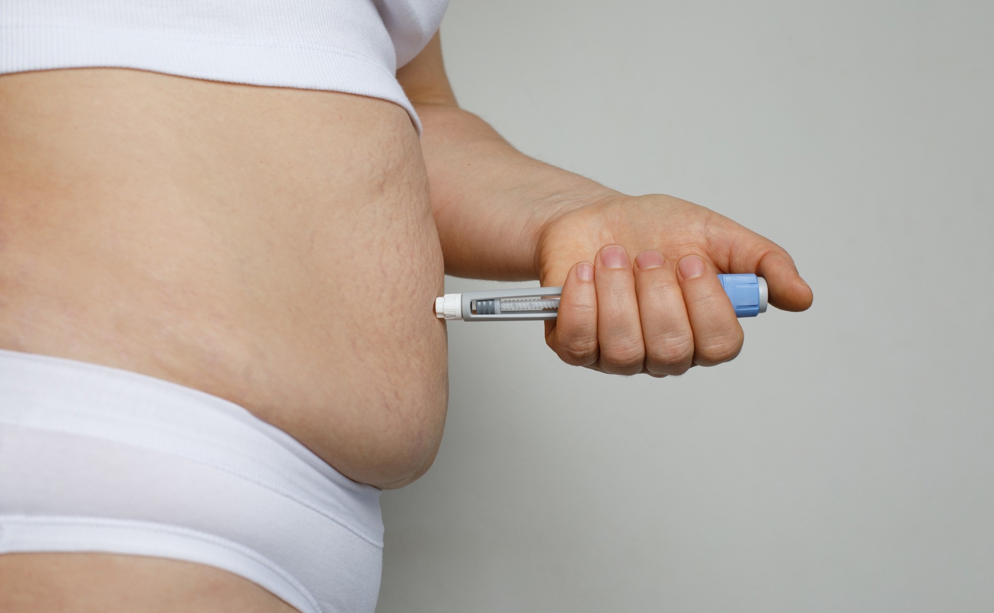 Clinical Research: Effect of combined GLP-1 analogue and bupropion/naltrexone on weight loss: a retrospective cohort study. Image Credit: MillaF / Shutterstock