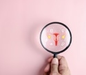 A Discussion with Hologic’s Tim Simpson on the Future of Cervical Cancer Screening