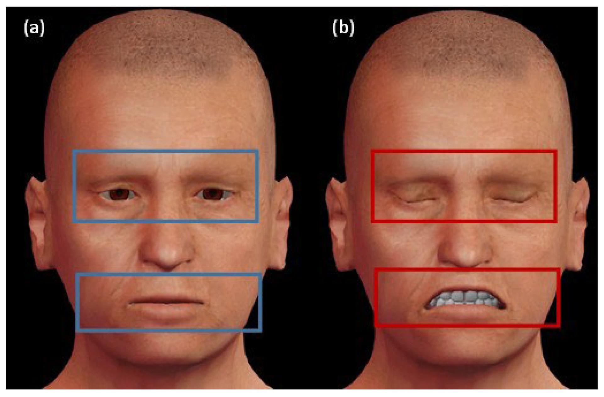 Facial expression areas that reveal if the patient is under deterioration or not. (a) The left avatar expresses a neutral expression, which is bounded by the blue rectangles. (b) The right avatar reveals deterioration status in the final stage, which is bounded by the red rectangles.