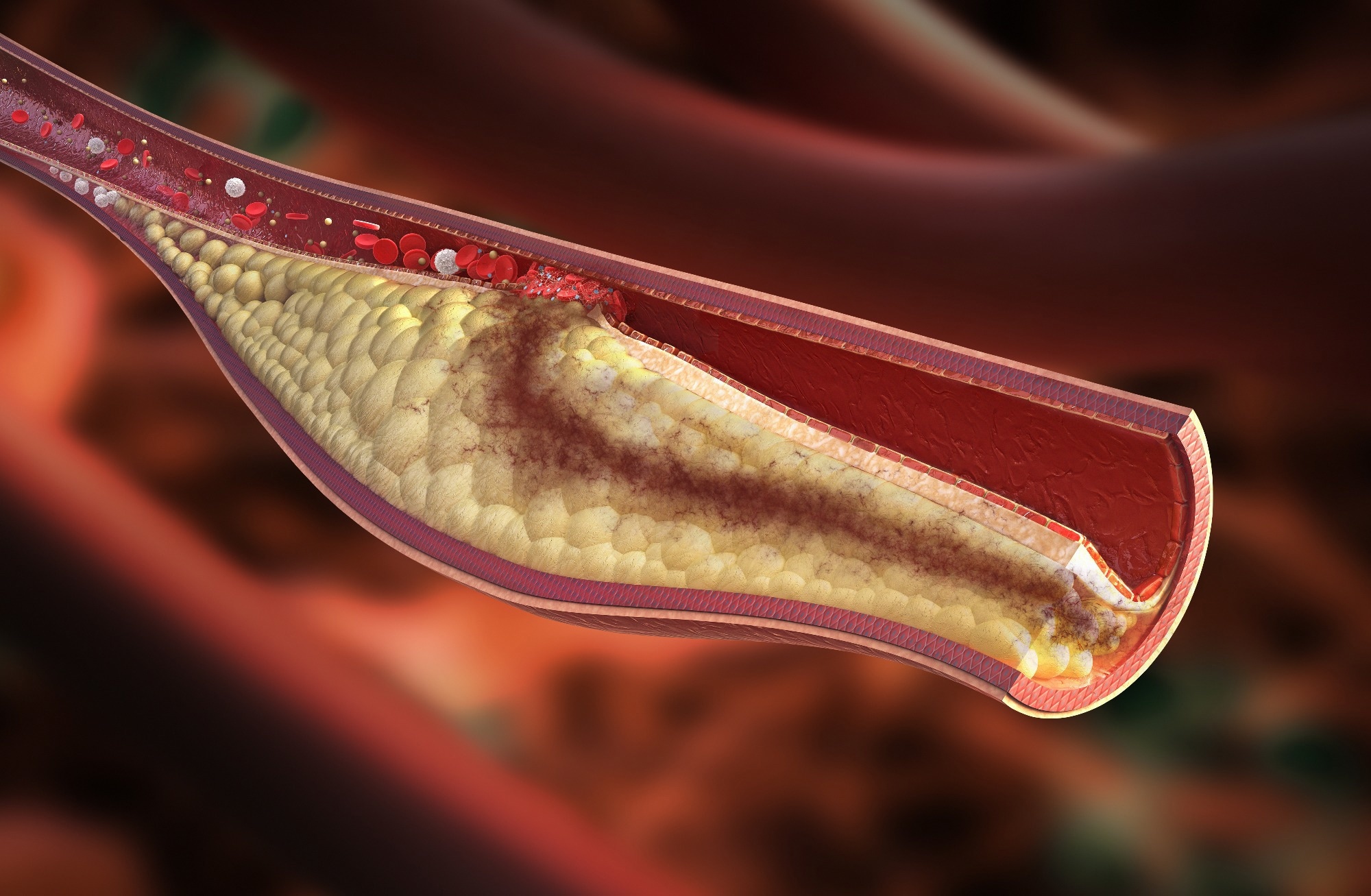 Study: Association between the atherogenic index of plasma and erectile dysfunction in US men: a population-based cross-sectional study. Image Credit: Rocos / Shutterstock