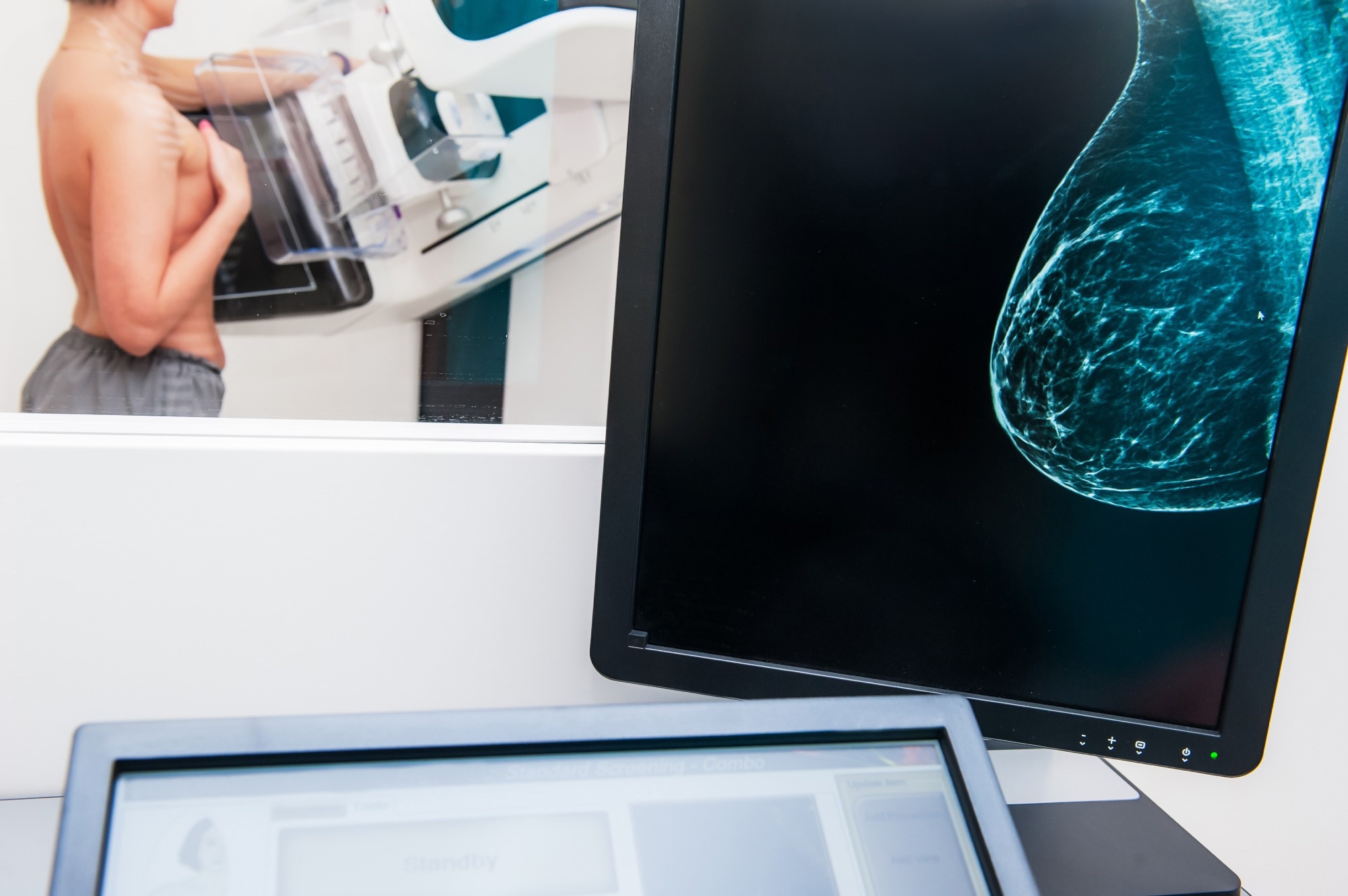 Study: Artificial Intelligence Algorithm for Subclinical Breast Cancer Detection. Image Credit: Okrasiuk / Shutterstock.com