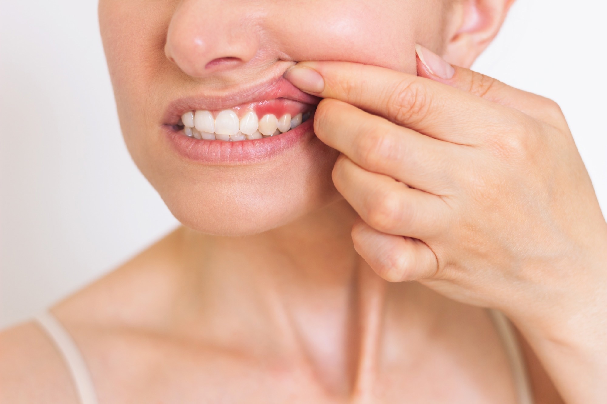 Study: Periodontitis impacts on thrombotic diseases: from clinical aspect to future therapeutic approaches. Image Credit: Olga by Shefer/Shutterstok.com