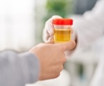 Innovative urine test could improve pancreatic cancer survival rates