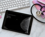 How AI is advancing mammographic density-based breast cancer risk prediction