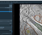 Amira Software Version 2024.2: Enhancing ultrastructure analysis