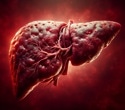 Study links low levels of PM2.5 exposure to liver damage